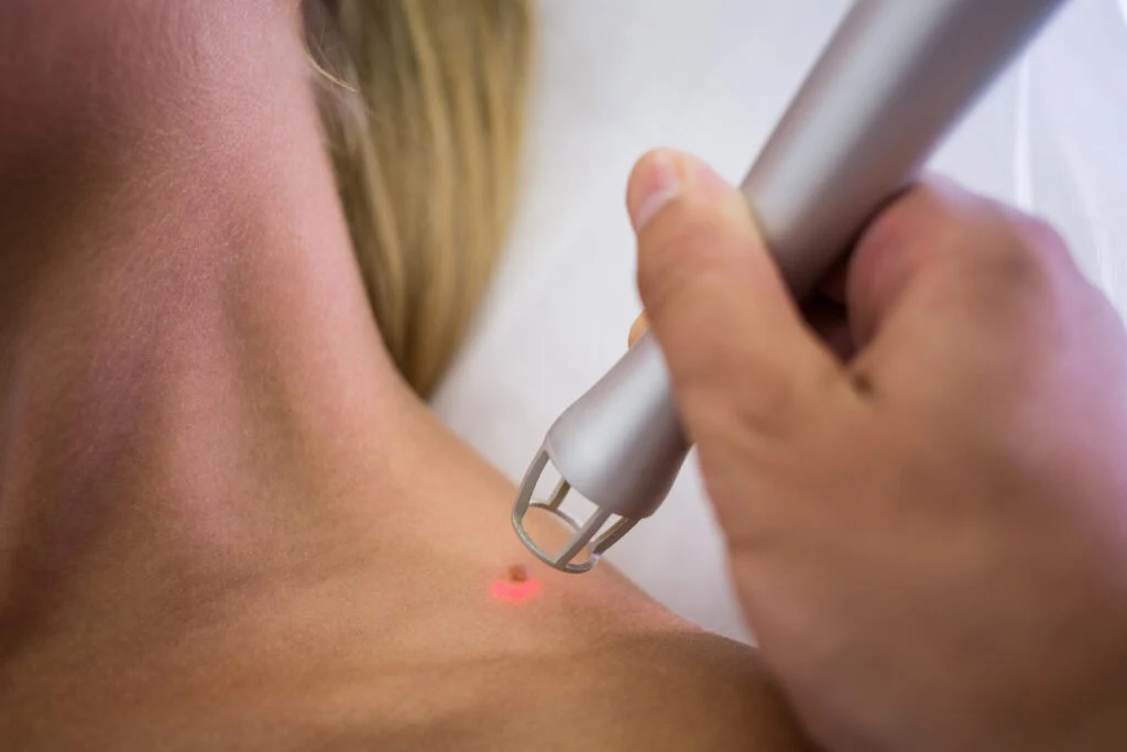Profesionalni aparati za salone Zoja Beauty