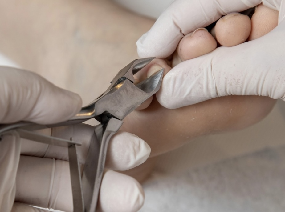 Medicinska pedikura in podologija v salonu Zoja Beauty