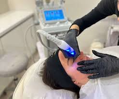 Napredna nega obraza z RF tretmajem v salonu Zoja Beauty